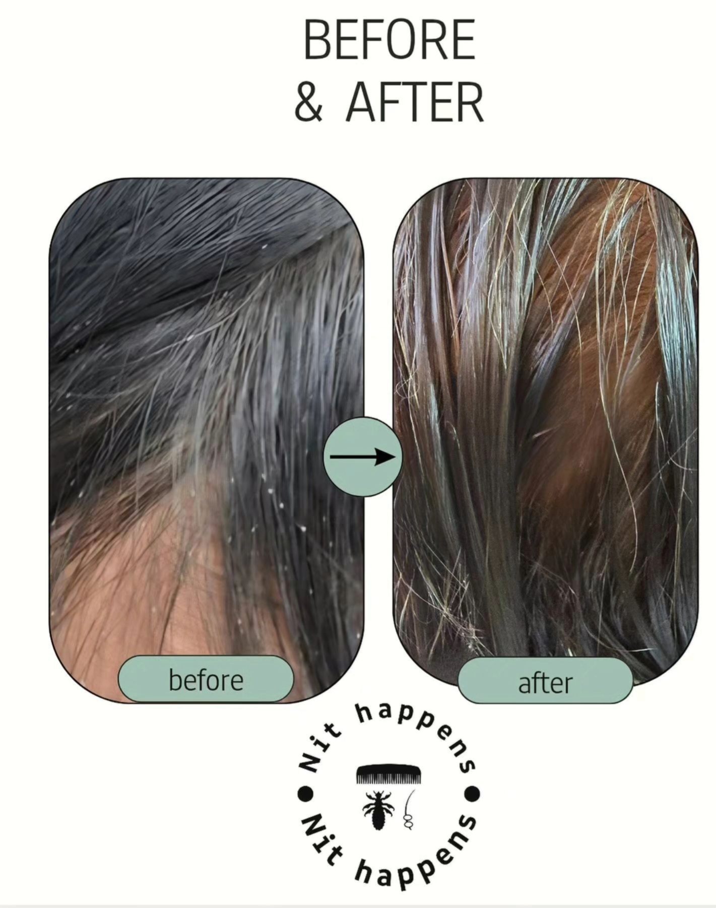 Nit Happens - Image 2