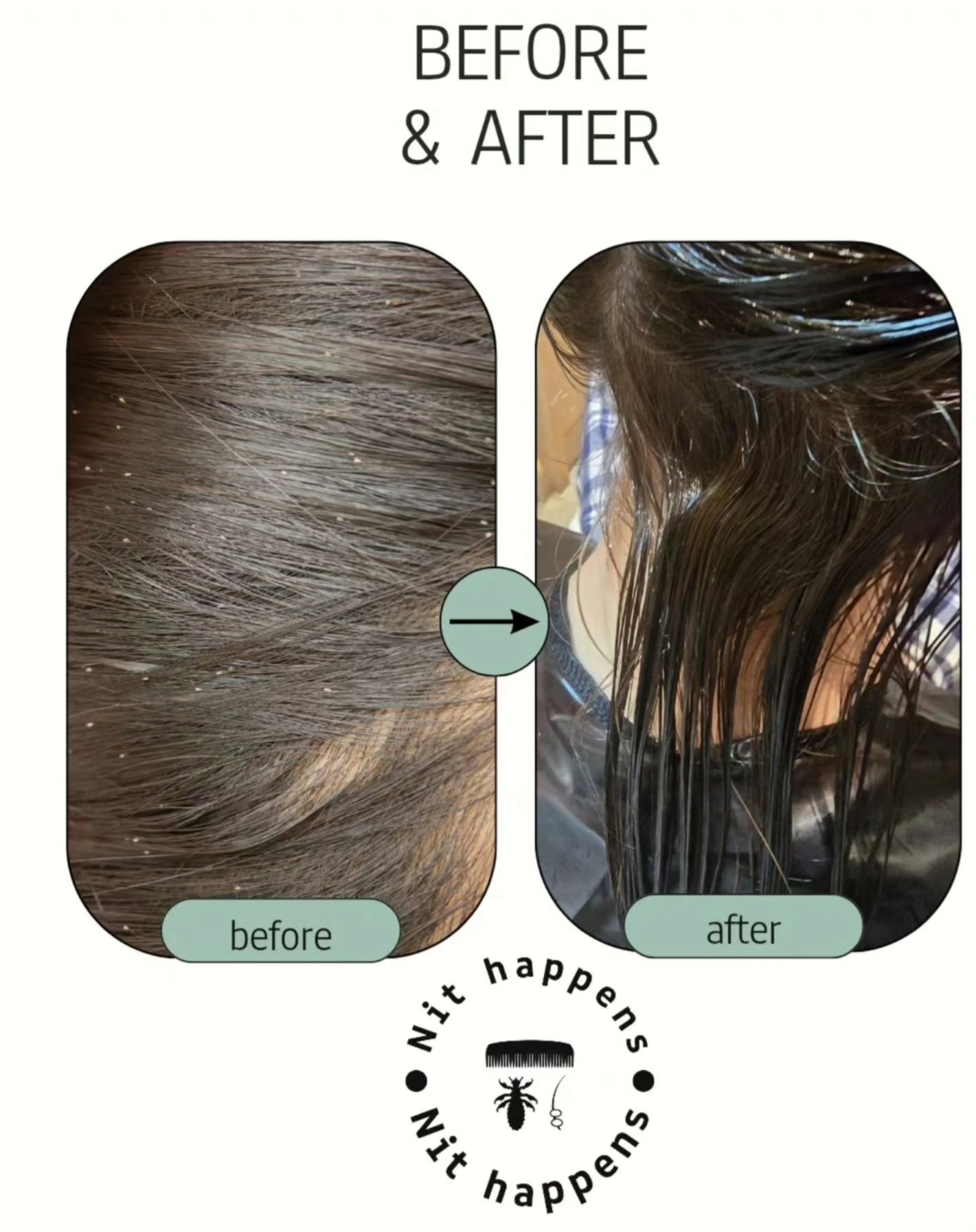 Nit Happens - Image 3