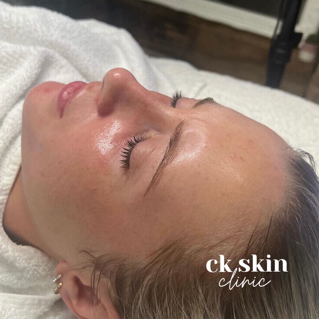 CK Skin Clinic - Image 3