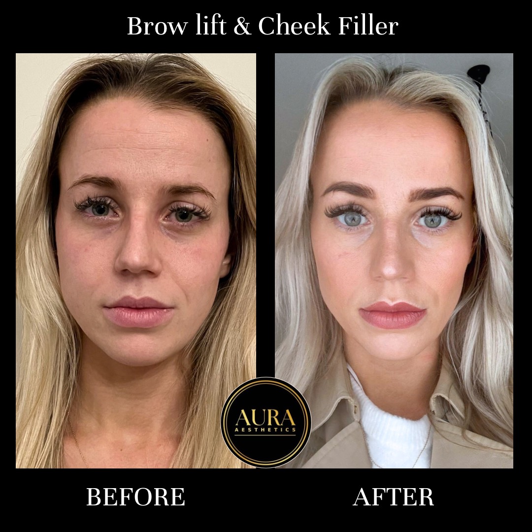 Aura Aesthetics - Image 3