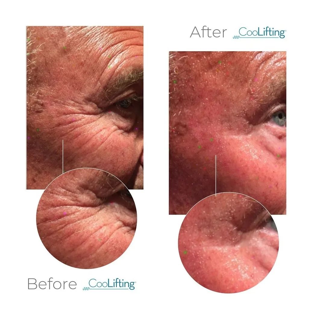 Wychwood Aesthetics - Image 3