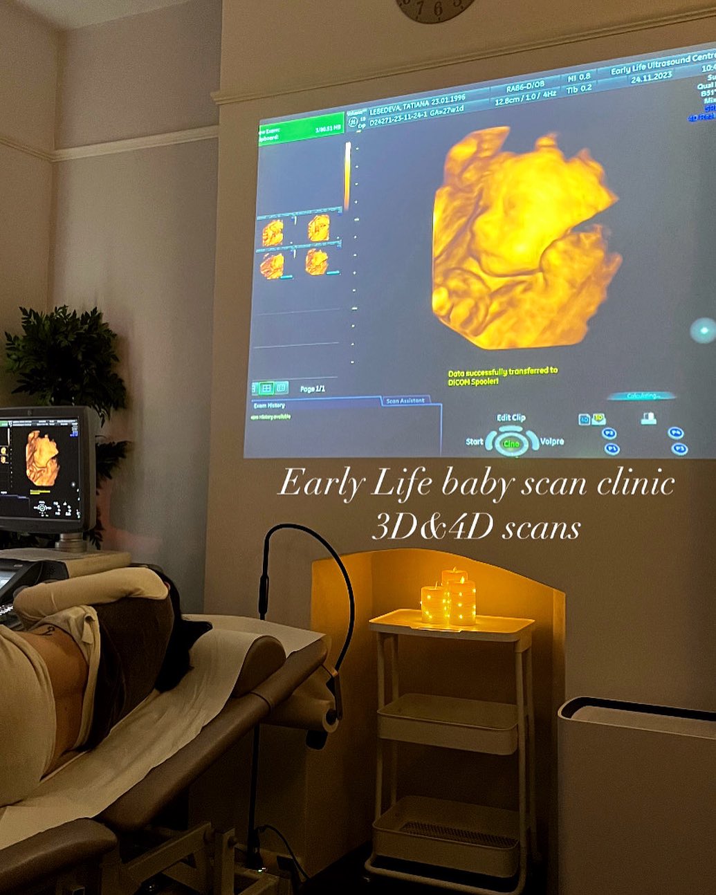 Early Life Ultrasound - Image 3