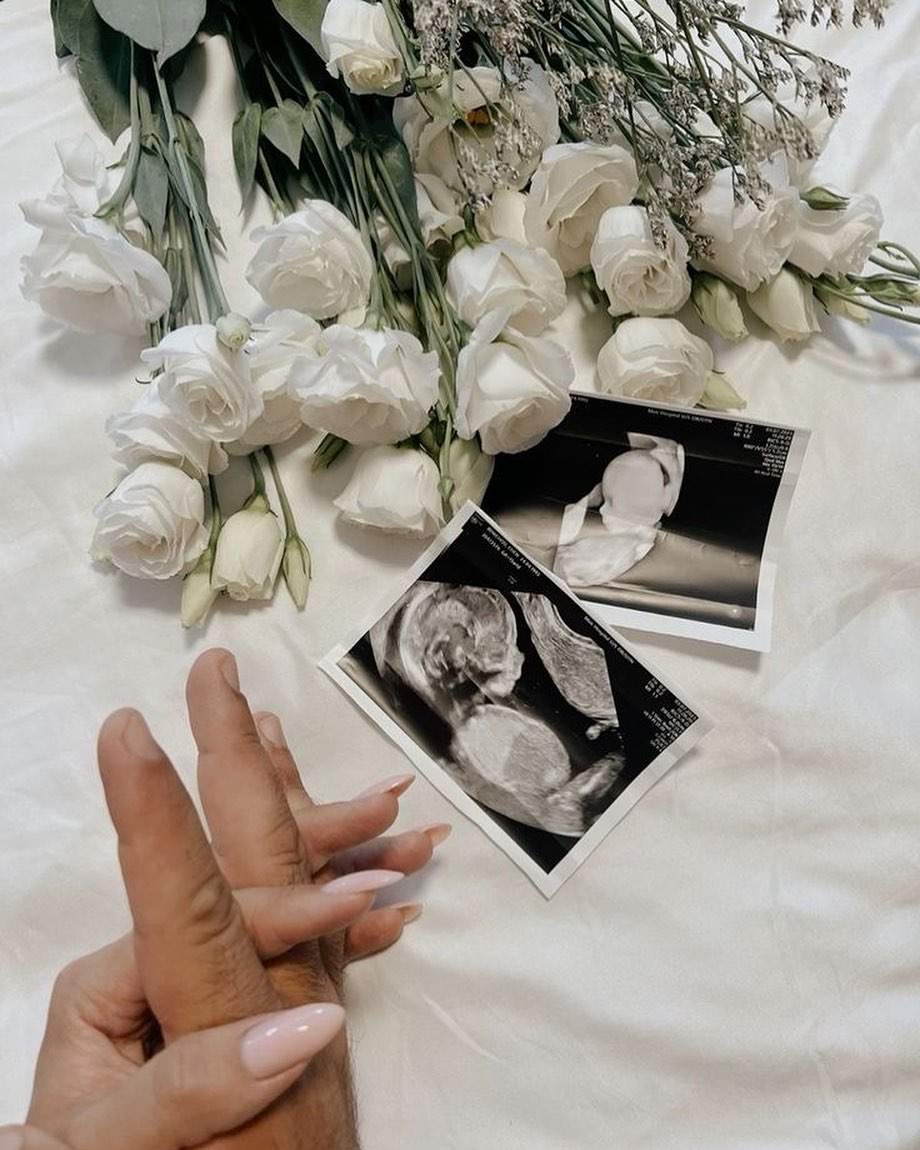 Early Life Ultrasound - Image 2