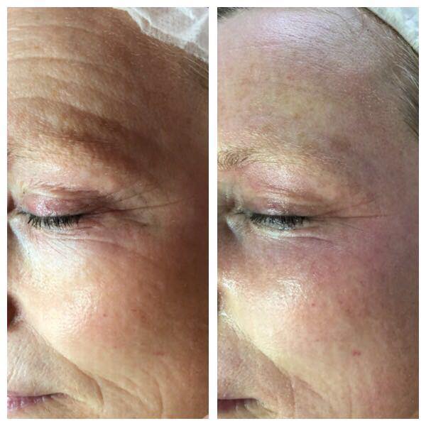 Sonia Norman Cheltenham Facials & Therapies - Image 3